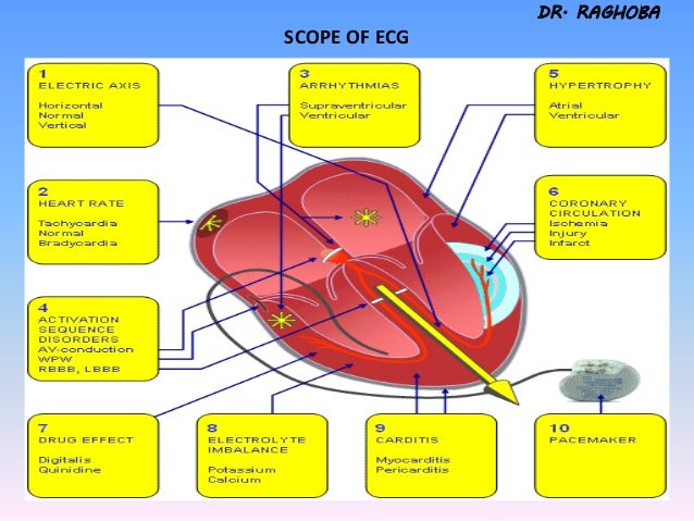 Ecg tutorial (2)