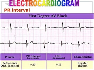Ecg update(basic cardiology) | PPTX