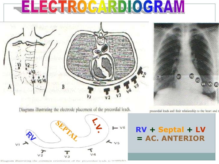 Ecg Update Basic Cardiology