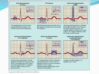 Comprehensive Overview of the Cardiac Cycle and ECG Interpretation for ...