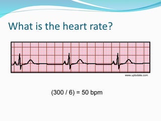 Comprehensive Overview of the Cardiac Cycle and ECG Interpretation for ...