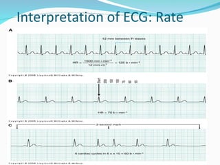 Comprehensive Overview of the Cardiac Cycle and ECG Interpretation for ...
