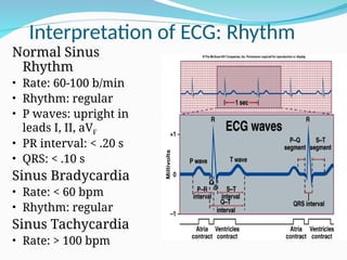 Comprehensive Overview of the Cardiac Cycle and ECG Interpretation for ...