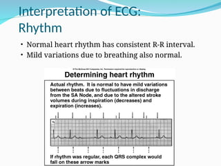 Comprehensive Overview of the Cardiac Cycle and ECG Interpretation for ...