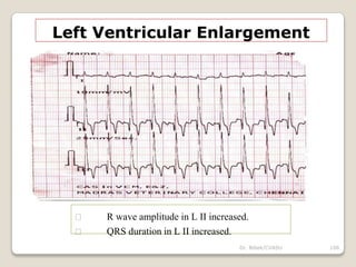 Dr. Bibek/CVASU 106
Left Ventricular Enlargement
R wave amplitude in L II increased.
QRS duration in L II increased.
 