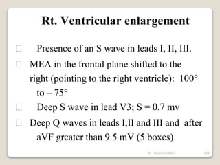Dr. Bibek/CVASU 108
Rt. Ventricular enlargement
Presence of an S wave in leads I, II, III.
MEA in the frontal plane shifted to the
right (pointing to the right ventricle): 100°
to – 75°
Deep S wave in lead V3; S = 0.7 mv
Deep Q waves in leads I,II and III and after
aVF greater than 9.5 mV (5 boxes)
 