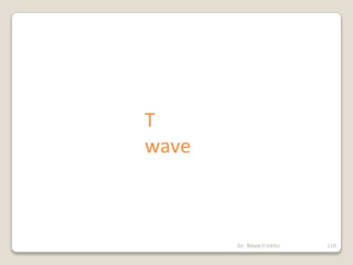 Dr. Bibek/CVASU 110
T
wave
 