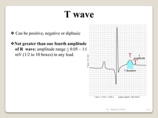 Dr. Bibek/CVASU 111
T wave
❖ Can be positive, negative or diphasic
❖Not greater than one fourth amplitude
of R wave; amplitude range + 0.05 – 1.0
mV (1/2 to 10 boxes) in any lead.
 