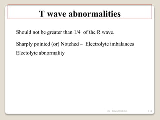 Dr. Bibek/CVASU 112
T wave abnormalities
Should not be greater than 1/4 of the R wave.
Sharply pointed (or) Notched – Electrolyte imbalances
Electolyte abnormality
 