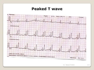 Dr. Bibek/CVASU 113
Peaked T wave
 