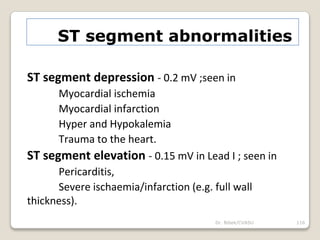Dr. Bibek/CVASU 116
ST segment abnormalities
ST segment depression - 0.2 mV ;seen in
Myocardial ischemia
Myocardial infarction
Hyper and Hypokalemia
Trauma to the heart.
ST segment elevation - 0.15 mV in Lead I ; seen in
Pericarditis,
Severe ischaemia/infarction (e.g. full wall
thickness).
 