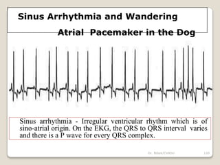 Dr. Bibek/CVASU 120
Sinus Arrhythmia and Wandering
Atrial Pacemaker in the Dog
Sinus arrhythmia - Irregular ventricular rhythm which is of
sino-atrial origin. On the EKG, the QRS to QRS interval varies
and there is a P wave for every QRS complex.
 