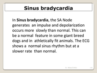 Dr. Bibek/CVASU 126
Sinus bradycardia
In Sinus bradycardia, the SA Node
generates an impulse and depolarization
occurs more slowly than normal. This can
be a normal feature in some giant breed
dogs and in athletically fit animals. The ECG
shows a normal sinus rhythm but at a
slower rate than normal.
 