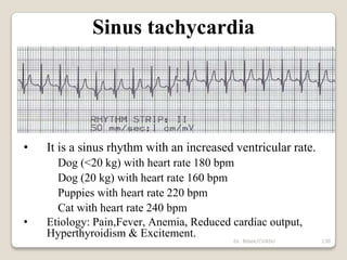 Dr. Bibek/CVASU 130
Sinus tachycardia
• It is a sinus rhythm with an increased ventricular rate.
Dog (<20 kg) with heart rate 180 bpm
Dog (20 kg) with heart rate 160 bpm
Puppies with heart rate 220 bpm
Cat with heart rate 240 bpm
• Etiology: Pain,Fever, Anemia, Reduced cardiac output,
Hyperthyroidism & Excitement.
 