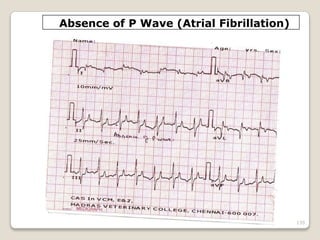 Dr. Bibek/CVASU 135
Absence of P Wave (Atrial Fibrillation)
 