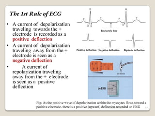 The 1st Rule of ECG
• A current of depolarization
traveling towards the +
electrode is recorded as a
positive deflection
• A current of depolarization
traveling away from the +
electrode is seen as a
negative deflection
• A current of
repolarization traveling
away from the + electrode
is seen as a positive
deflection
Fig: As the positive wave of depolarization within the myocytes flows toward a
positive electrode, there is a positive (upward) deflection recorded on EKG
Positive deflection Negative deflection Biphasic deflection
Isoelectric line
14
Dr. Bibek/CVASU
 