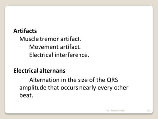 Dr. Bibek/CVASU 152
Artifacts
Muscle tremor artifact.
Movement artifact.
Electrical interference.
Electrical alternans
Alternation in the size of the QRS
amplitude that occurs nearly every other
beat.
 