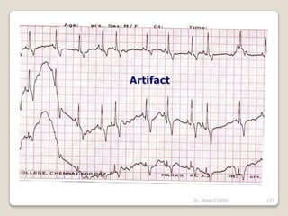 Dr. Bibek/CVASU 153
Artifact
 