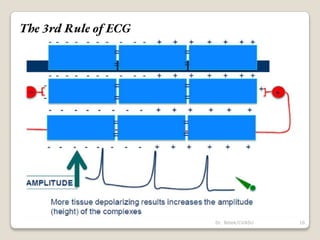 The 3rd Rule of ECG
16
Dr. Bibek/CVASU
 