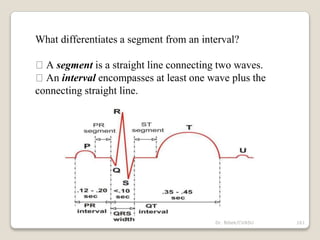 What differentiates a segment from an interval?
A segment is a straight line connecting two waves.
An interval encompasses at least one wave plus the
connecting straight line.
161
Dr. Bibek/CVASU
 
