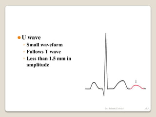 Dr. Bibek/CVASU 163
⚫U wave
◦ Small waveform
◦ Follows T wave
◦ Less than 1.5 mm in
amplitude
 