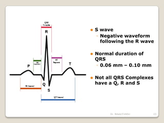 Dr. Bibek/CVASU 23
⚫ S wave
◦ Negative waveform
following the R wave
⚫ Normal duration of
QRS
◦ 0.06 mm – 0.10 mm
⚫ Not all QRS Complexes
have a Q, R and S
 