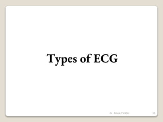 Types of ECG
26
Dr. Bibek/CVASU
 