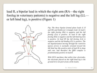 lead II, a bipolar lead in which the right arm (RA—the right
foreleg in veterinary patients) is negative and the left leg (LL—
or left hind leg), is positive (Figure 1)
Fig: The three bipolar frontal plane leads (I, II
and III) and Einthoven’s triangle (red). In lead I,
the right foreleg (RA) is negative and the left
foreleg (LA) is positive. In lead II the right
foreleg (RA) is negative and the left hind leg (LL)
is positive. In lead III the left foreleg (LA) is
negative and the left hindleg (LL) is positive. The
net depolarization moving through the ventricles
(green arrow) is normally oriented toward the
left hind leg (the positive pole of lead II) in dogs
and cats, and therefore the QRS complex is
predominantly positive in lead II.
With ECG machines that utilize four electrodes,
the electrode placed on the right hind leg is the
ground (it is not part of any of the leads).
39
Dr. Bibek/CVASU
 