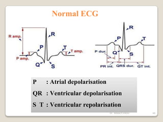 Normal ECG
P
QR
S T
: Atrial depolarisation
: Ventricular depolarisation
: Ventricular repolarisation
48
Dr. Bibek/CVASU
 