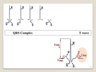 QRS Complex T wave
49
Dr. Bibek/CVASU
 