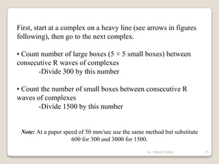 Dr. Bibek/CVASU 75
First, start at a complex on a heavy line (see arrows in figures
following), then go to the next complex.
▪ Count number of large boxes (5 × 5 small boxes) between
consecutive R waves of complexes
-Divide 300 by this number
▪ Count the number of small boxes between consecutive R
waves of complexes
-Divide 1500 by this number
Note: At a paper speed of 50 mm/sec use the same method but substitute
600 for 300 and 3000 for 1500.
 