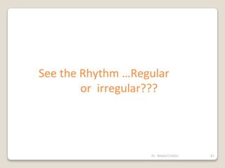 Dr. Bibek/CVASU 81
See the Rhythm …Regular
or irregular???
 