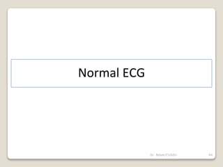 Dr. Bibek/CVASU 94
Normal ECG
 