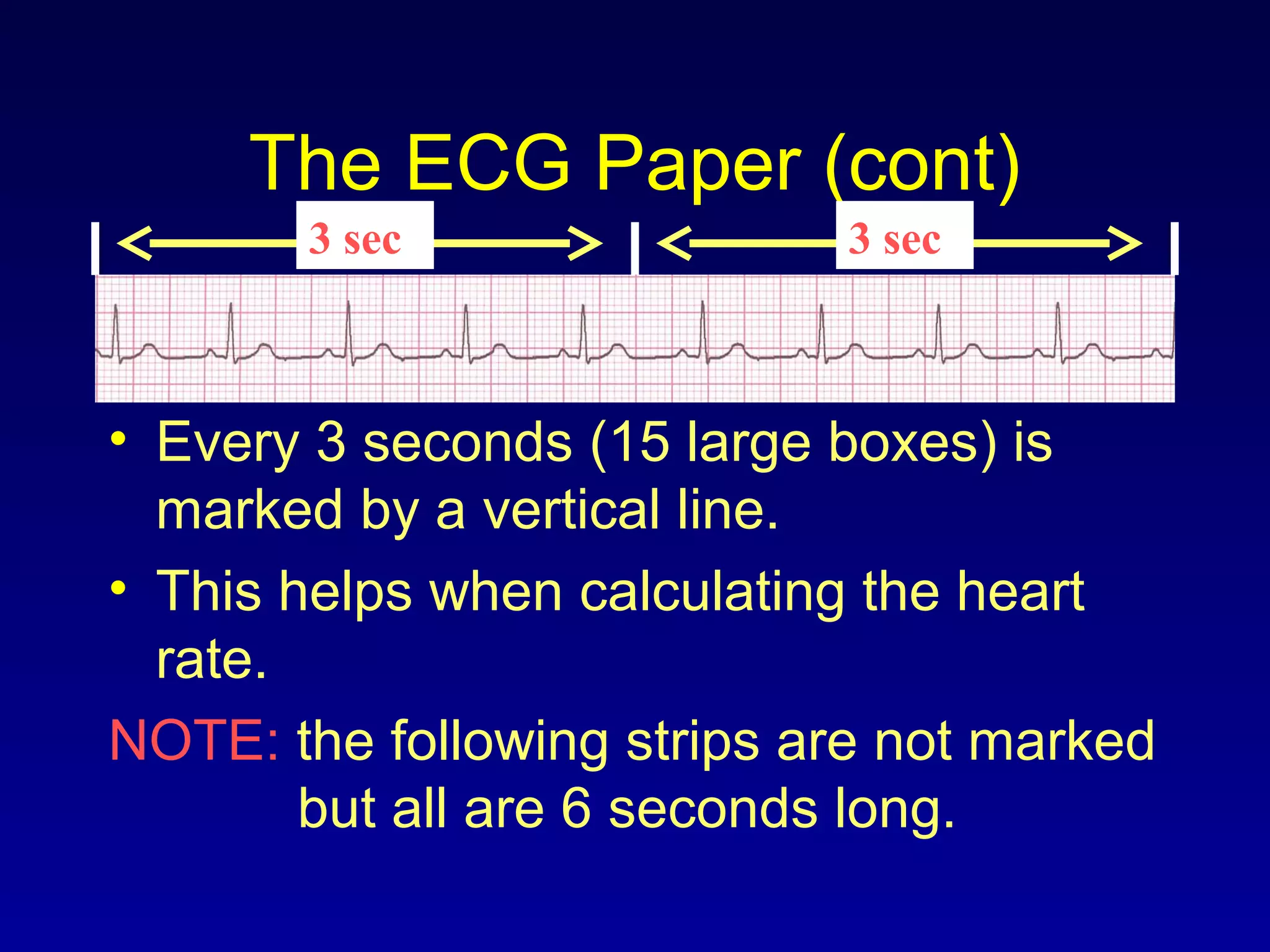 The ECG Paper (cont)
• Every 3 seconds (15 large boxes) is
marked by a vertical line.
• This helps when calculating the heart
rate.
NOTE: the following strips are not marked
but all are 6 seconds long.
3 sec 3 sec
 
