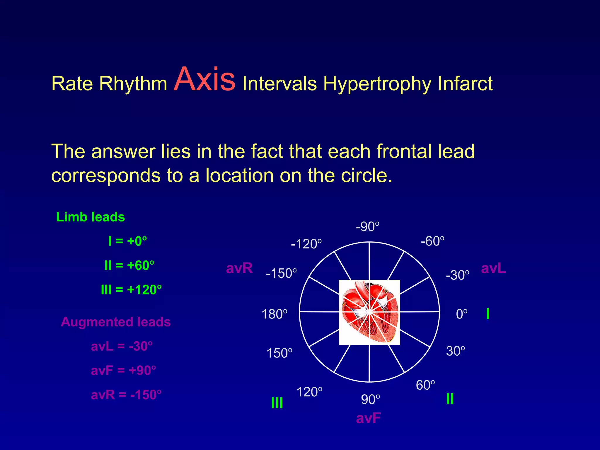 Rate Rhythm Axis Intervals Hypertrophy Infarct
The answer lies in the fact that each frontal lead
corresponds to a location on the circle.
0o
30o
-30o
60o
-60o
-90o
-120o
90o120o
150o
180o
-150o
I
II
avF
avLavR
Limb leads
I = +0o
II = +60o
III = +120o
Augmented leads
avL = -30o
avF = +90o
avR = -150o
I
IIIII
 