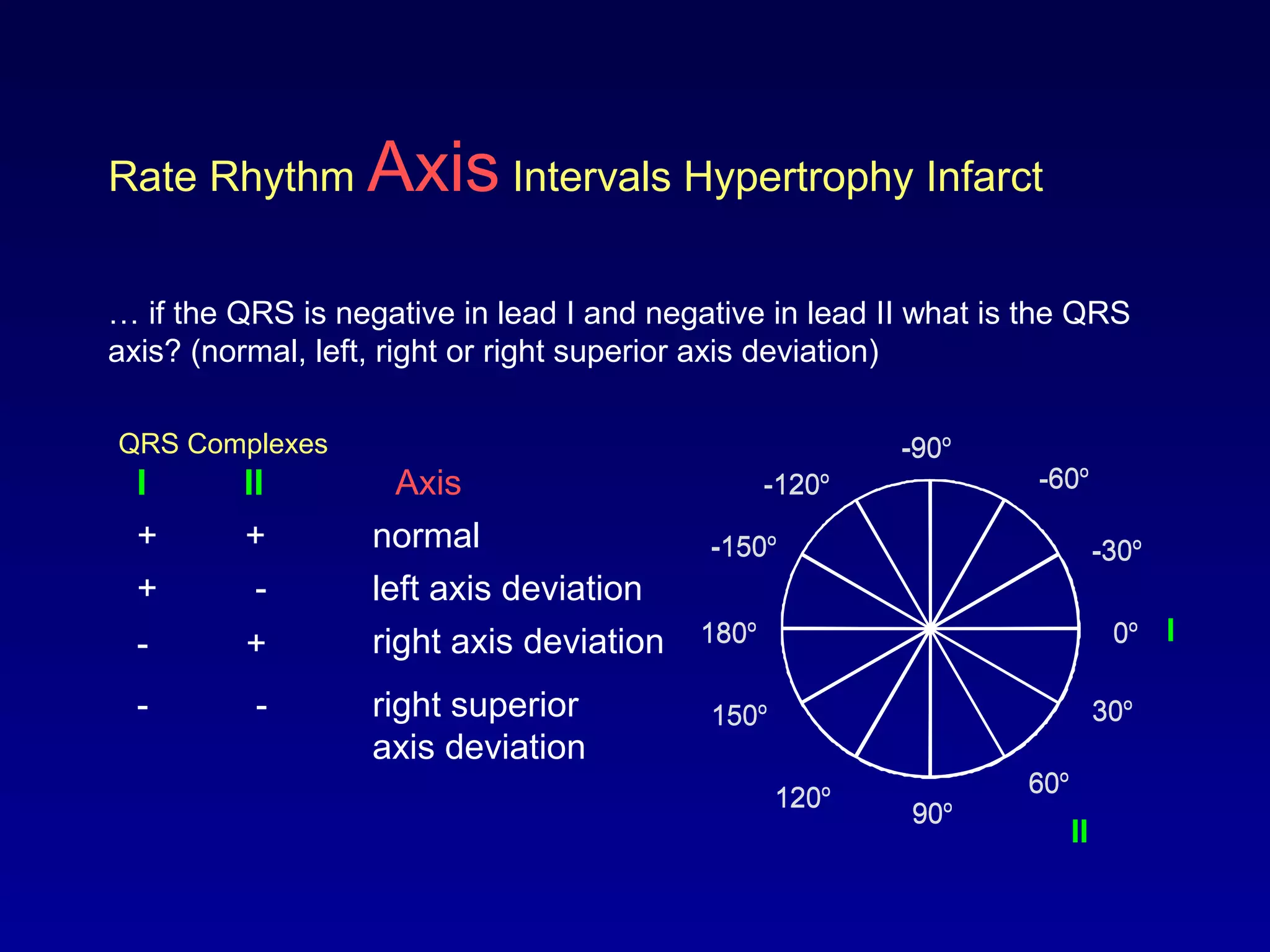 0o
30o
-30o
60o
-60o
-90o
-120o
90o120o
150o
180o
-150o
Rate Rhythm Axis Intervals Hypertrophy Infarct
… if the QRS is negative in lead I and negative in lead II what is the QRS
axis? (normal, left, right or right superior axis deviation)
QRS Complexes
I
AxisI II
+ +
+ -
- +
- -
normal
left axis deviation
right axis deviation
right superior
axis deviation
0o
30o
-30o
60o
-60o
-90o
-120o
90o120o
150o
180o
-150o
II
 
