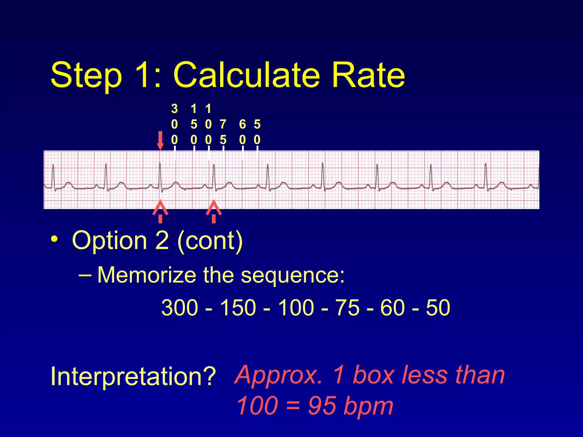 Step 1: Calculate Rate
• Option 2 (cont)
– Memorize the sequence:
300 - 150 - 100 - 75 - 60 - 50
Interpretation?
3
0
0
1
5
0
1
0
0
7
5
6
0
5
0
Approx. 1 box less than
100 = 95 bpm
 