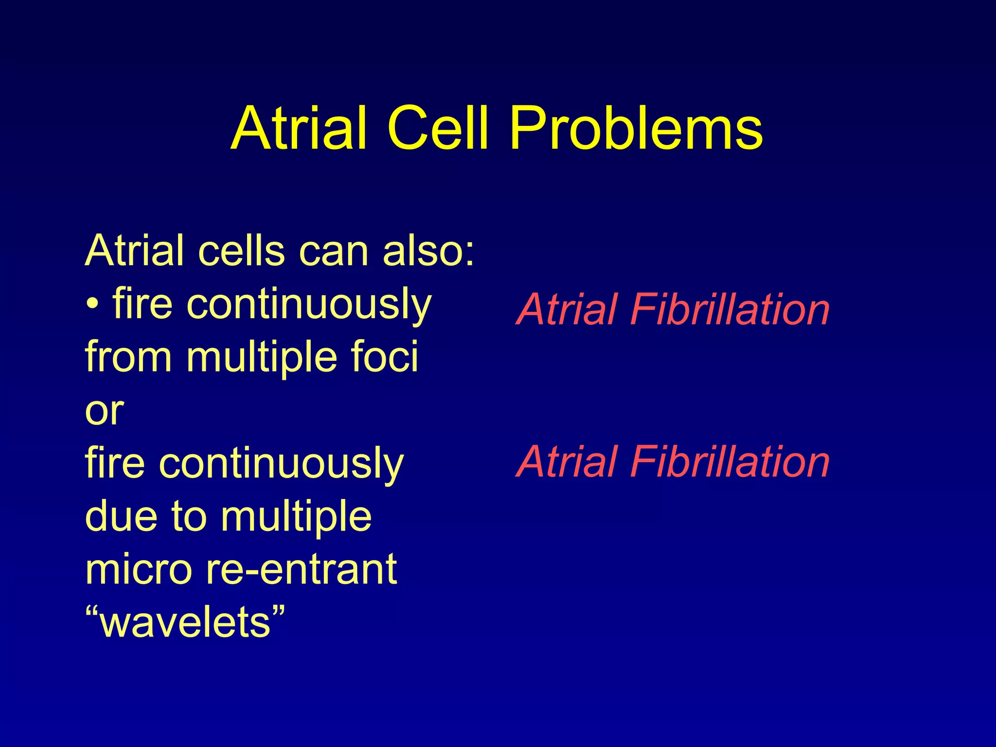 Atrial Cell Problems
Atrial cells can also:
• fire continuously
from multiple foci
or
fire continuously
due to multiple
micro re-entrant
“wavelets”
Atrial Fibrillation
Atrial Fibrillation
 