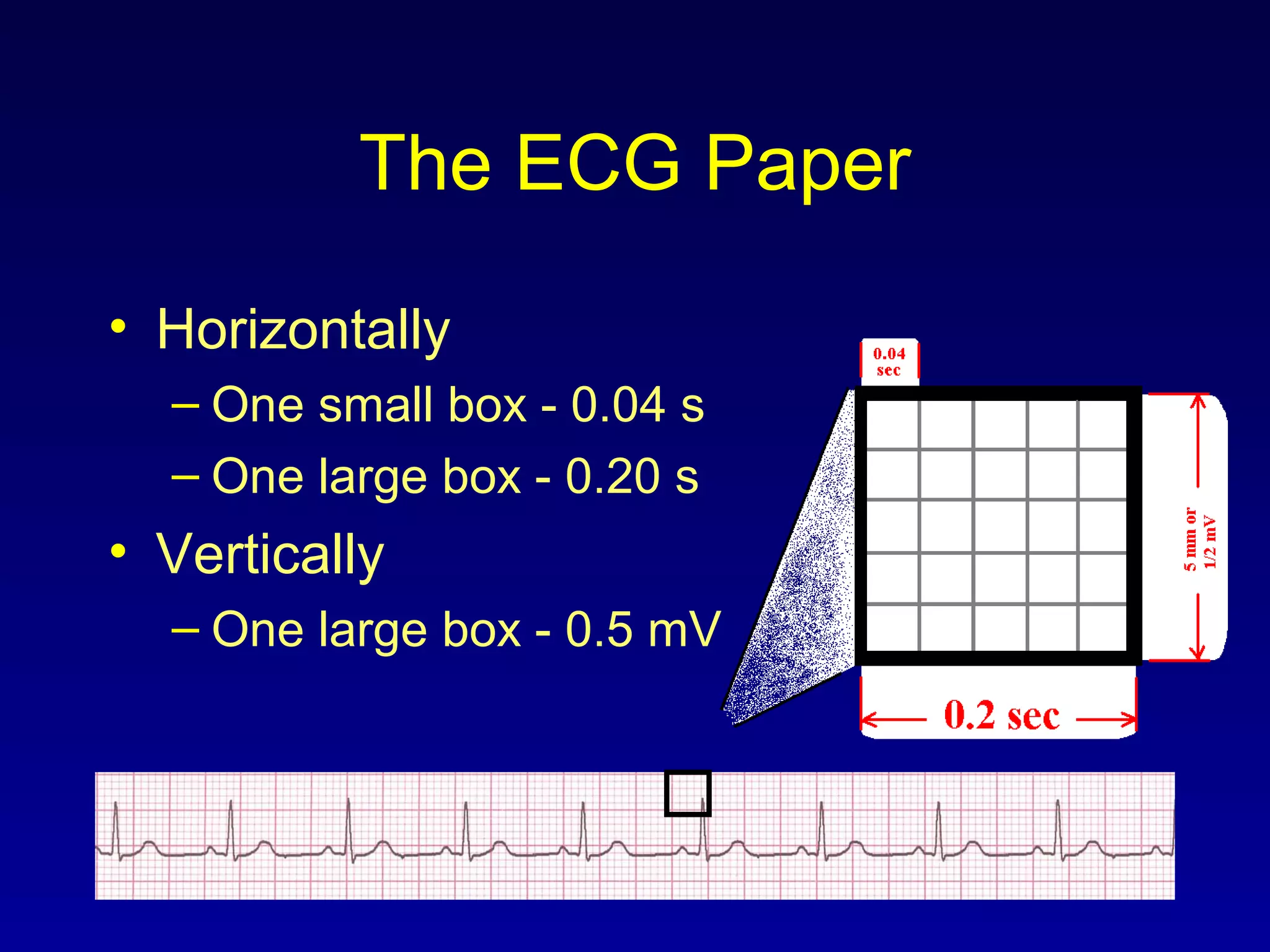 The ECG Paper
• Horizontally
– One small box - 0.04 s
– One large box - 0.20 s
• Vertically
– One large box - 0.5 mV
 