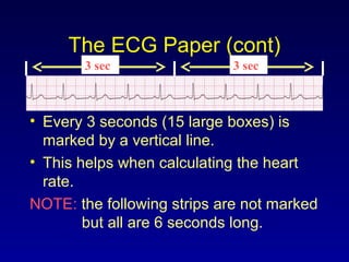 The ECG Paper (cont)
• Every 3 seconds (15 large boxes) is
marked by a vertical line.
• This helps when calculating the heart
rate.
NOTE: the following strips are not marked
but all are 6 seconds long.
3 sec 3 sec
 