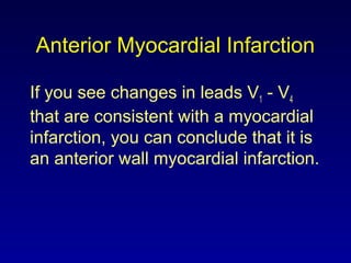 Anterior Myocardial Infarction
If you see changes in leads V1 - V4
that are consistent with a myocardial
infarction, you can conclude that it is
an anterior wall myocardial infarction.
 
