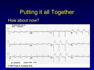 Putting it all Together
How about now?
 