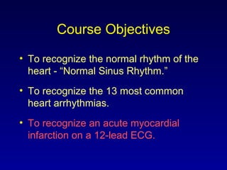 Course Objectives
• To recognize the normal rhythm of the
heart - “Normal Sinus Rhythm.”
• To recognize the 13 most common
heart arrhythmias.
• To recognize an acute myocardial
infarction on a 12-lead ECG.
 