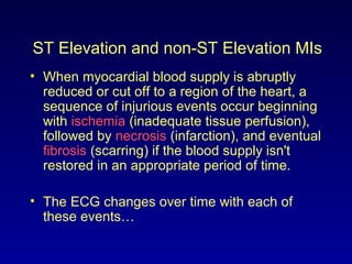 ST Elevation and non-ST Elevation MIs
• When myocardial blood supply is abruptly
reduced or cut off to a region of the heart, a
sequence of injurious events occur beginning
with ischemia (inadequate tissue perfusion),
followed by necrosis (infarction), and eventual
fibrosis (scarring) if the blood supply isn't
restored in an appropriate period of time.
• The ECG changes over time with each of
these events…
 