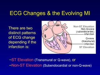 ECG Changes & the Evolving MI
There are two
distinct patterns
of ECG change
depending if the
infarction is:
–ST Elevation (Transmural or Q-wave), or
–Non-ST Elevation (Subendocardial or non-Q-wave)
Non-ST Elevation
ST Elevation
 