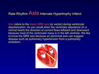 Rate Rhythm Axis Intervals Hypertrophy Infarct
Axis refers to the mean QRS axis (or vector) during ventricular
depolarization. As you recall when the ventricles depolarize (in a
normal heart) the direction of current flows leftward and downward
because most of the ventricular mass is in the left ventricle. We like
to know the QRS axis because an abnormal axis can suggest
disease such as pulmonary hypertension from a pulmonary
embolism.
 