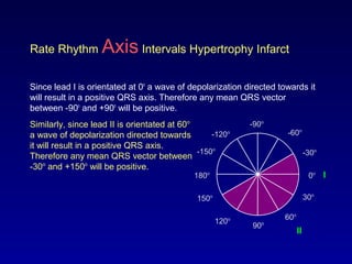 0o
30o
-30o
60o
-60o
-90o
-120o
90o120o
150o
180o
-150o
Rate Rhythm Axis Intervals Hypertrophy Infarct
Since lead I is orientated at 0o
a wave of depolarization directed towards it
will result in a positive QRS axis. Therefore any mean QRS vector
between -90o
and +90o
will be positive.
Similarly, since lead II is orientated at 60o
a wave of depolarization directed towards
it will result in a positive QRS axis.
Therefore any mean QRS vector between
-30o
and +150o
will be positive.
I
II
 