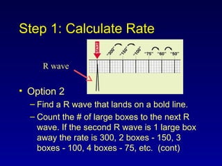 Step 1: Calculate Rate
• Option 2
– Find a R wave that lands on a bold line.
– Count the # of large boxes to the next R
wave. If the second R wave is 1 large box
away the rate is 300, 2 boxes - 150, 3
boxes - 100, 4 boxes - 75, etc. (cont)
R wave
 