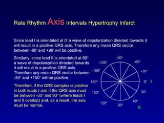 0o
30o
-30o
60o
-60o
-90o
-120o
90o120o
150o
180o
-150o
Rate Rhythm Axis Intervals Hypertrophy Infarct
Since lead I is orientated at 0o
a wave of depolarization directed towards it
will result in a positive QRS axis. Therefore any mean QRS vector
between -90o
and +90o
will be positive.
Similarly, since lead II is orientated at 60o
a wave of depolarization directed towards
it will result in a positive QRS axis.
Therefore any mean QRS vector between
-30o
and +150o
will be positive.
Therefore, if the QRS complex is positive
in both leads I and II the QRS axis must
be between -30o
and 90o
(where leads I
and II overlap) and, as a result, the axis
must be normal.
I
II
 