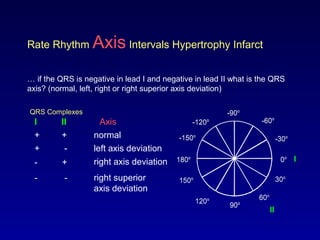 0o
30o
-30o
60o
-60o
-90o
-120o
90o120o
150o
180o
-150o
Rate Rhythm Axis Intervals Hypertrophy Infarct
… if the QRS is negative in lead I and negative in lead II what is the QRS
axis? (normal, left, right or right superior axis deviation)
QRS Complexes
I
AxisI II
+ +
+ -
- +
- -
normal
left axis deviation
right axis deviation
right superior
axis deviation
0o
30o
-30o
60o
-60o
-90o
-120o
90o120o
150o
180o
-150o
II
 